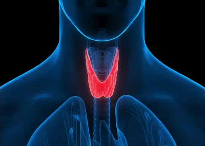 hasimato tiroidi tedavisi